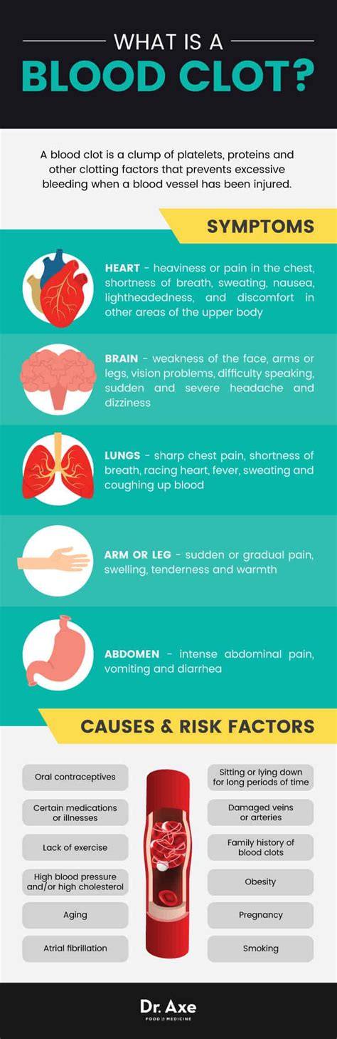clotsiti|Blood clots Causes .